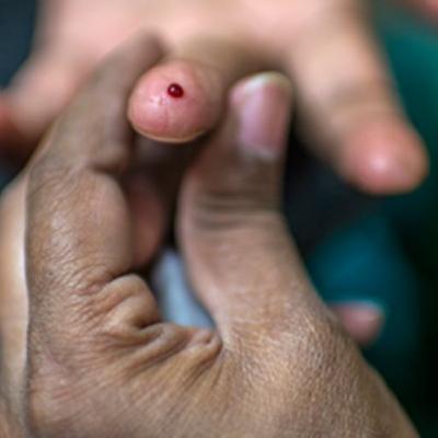 Día Mundial de la Diabetes: ¿Cómo evitar la ceguera causada por esta enfermedad??