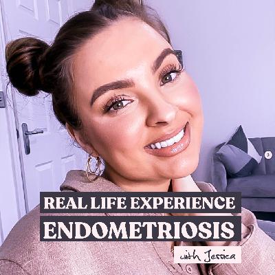 Endometriosis | A Real Life Story