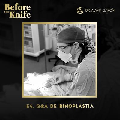 004 - Q&A de Rinoplastía