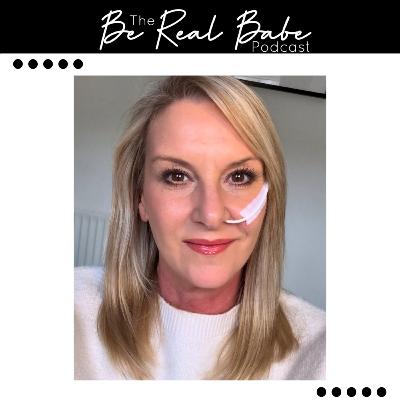 Episode 237 Being real about Botox injury #6 Episode 237 Being real about Botox injury #6