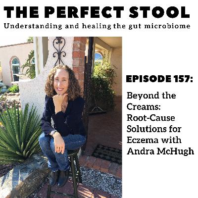 Beyond the Creams: Root-Cause Solutions for Eczema with Andra McHugh