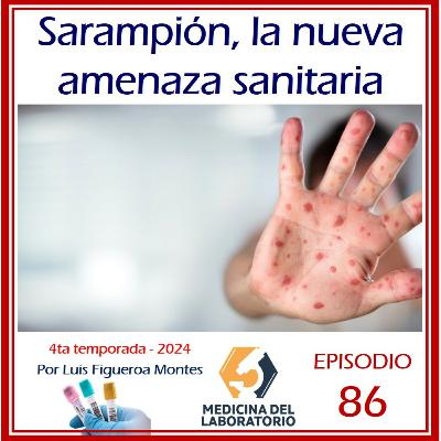 Sarampión, nueva amanezca sanitaria Sarampión, nueva amanezca sanitaria