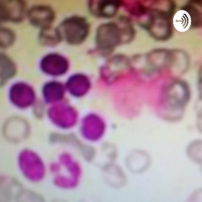 Leucemia Linfoide Crônica-LLC