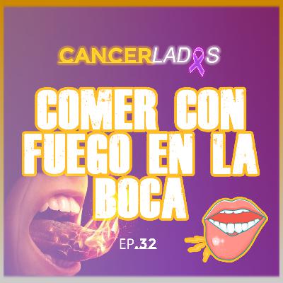 Alimentación con mucositis: cómo comer con fuego en la boca - Cancerlados Ep.32
