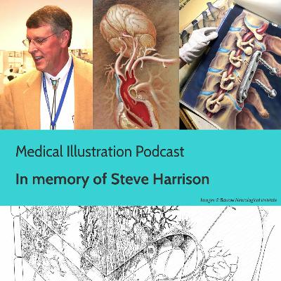 MIP - Steve Harrison