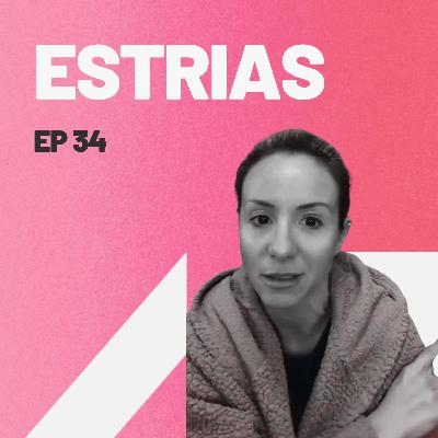 Estrias
