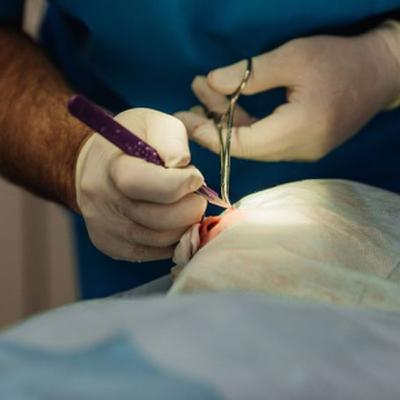 Does the Removal of Sutures Hurt? | CPT Codes & ICD-10 Guide – Learn about suture removal pain, CPT codes, procedure types, and ICD-10 classifications.