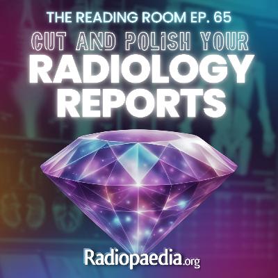 65. Cut and polish your radiology reports