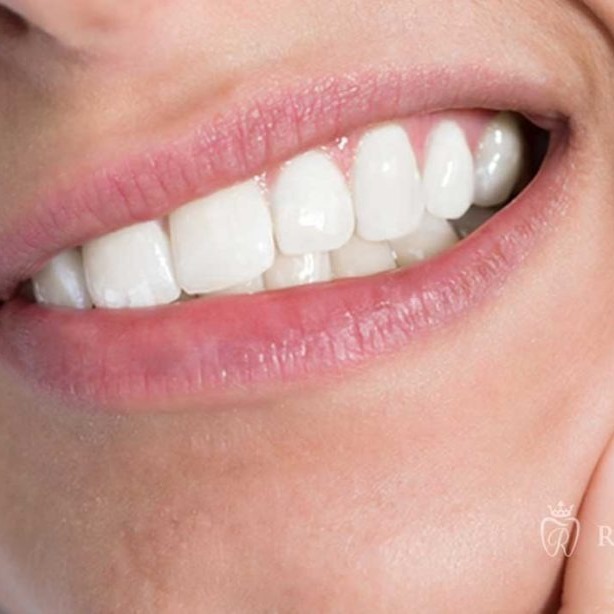 5 Tips for Maintaining a Bright, Healthy Smile