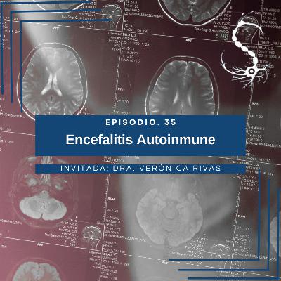 35. Encefalitis Autoinmune 35. Encefalitis Autoinmune