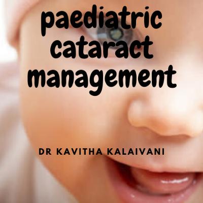 Management of paediatric cataracts