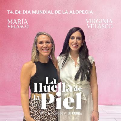 T4. E4. Virginia Velasco: Alopecia femenina