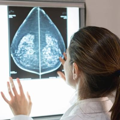 Breast Cancer and 'the right to be forgotten'