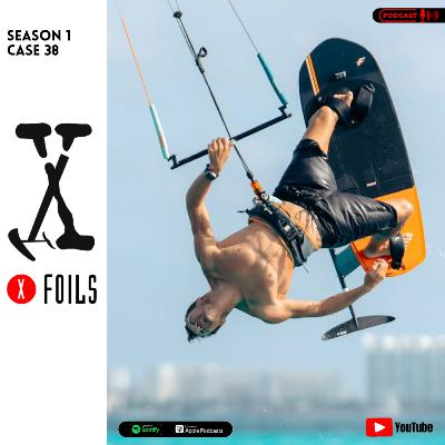 Case #38 – Maxime from Shaka Vibes Cancun