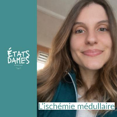 Au cœur de l’ischémie médullaire : du jour au lendemain, ma vie a basculé Au cœur de l’ischémie médullaire : du jour au lendemain, ma vie a basculé