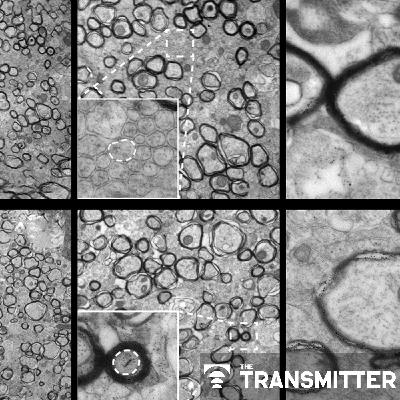 Oligodendrocytes need mechanical cues to myelinate axons correctly