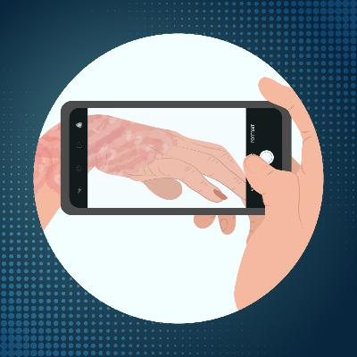 Audio Guide - Psoriatic Arthritis Symptoms