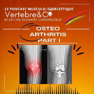 OsteoArthritis Part I OsteoArthritis Part I