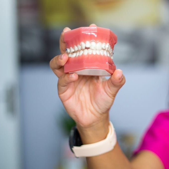 The OPTISMILE Podcast 98 - Crown Lengthening – Fixing the Gummy Smile