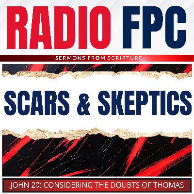 John: Of Scars And Skeptics
