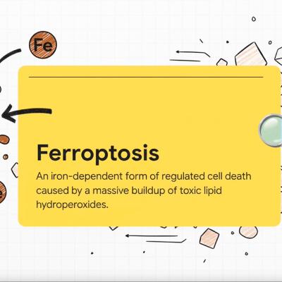 Ferroptosis and Vision Loss: How Iron-Driven Cell Death Shapes Age-Related Macular Degeneration (AMD) and the Future of Retinal Neuroprotection Research
