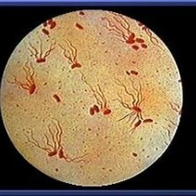 What is the difference between Typhoid and Typhus?