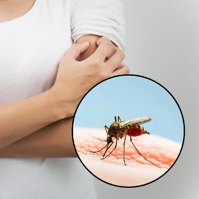 Cùng ở một chỗ, vì sao có người bị muỗi chích nhiều, người thì không?