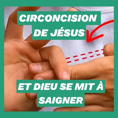 Circoncision de Jésus : et Dieu se mit à saigner Circoncision de Jésus : et Dieu se mit à saigner