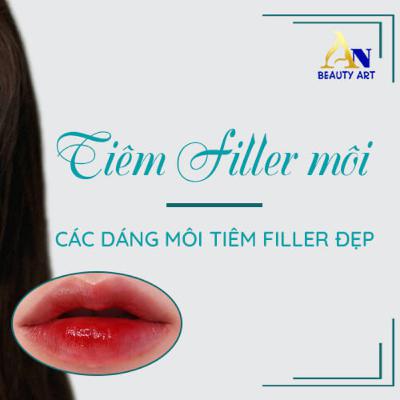 Dáng Môi Tiêm Filler Đẹp và Top 8 Dáng Môi Thịnh Hành Nhất 2023