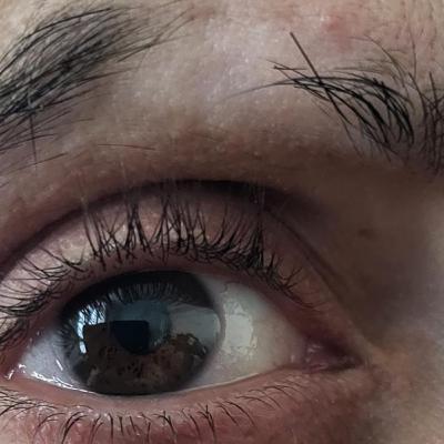 "Brow Deep: Unraveling the Emotions Behind My Lost Eyebrow" Part I