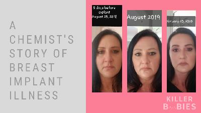 A Chemist's Experience in Having Breast Implant Illness