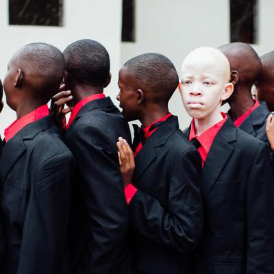El Kudu blanco. El drama de los Albinos en algunos países de Africa El Kudu blanco. El drama de los Albinos en algunos países de Africa