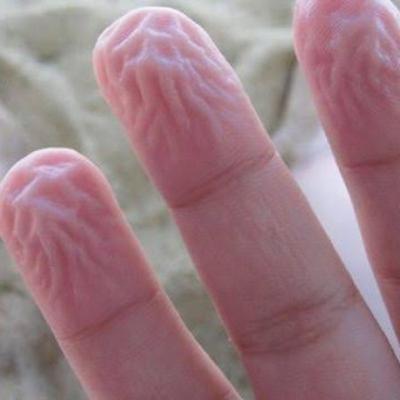 Porque se arrugan los dedos en el agua? Porque se arrugan los dedos en el agua?