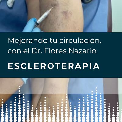 Escleroterapia. Escleroterapia.