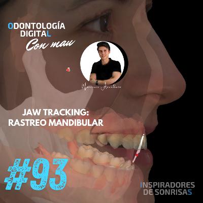 E93-JAW TRACKING: Rastreo Mandibular E93-JAW TRACKING: Rastreo Mandibular