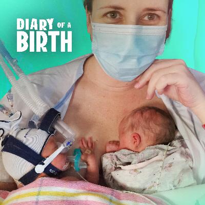Dealing With TAPS: One Of The Rarest Twin Complications Ever Dealing With TAPS: One Of The Rarest Twin Complications Ever