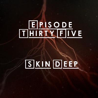 #35 - S2 E13: Skin Deep