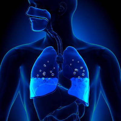 Episode 31: Acute Distress Respiratory Syndrome