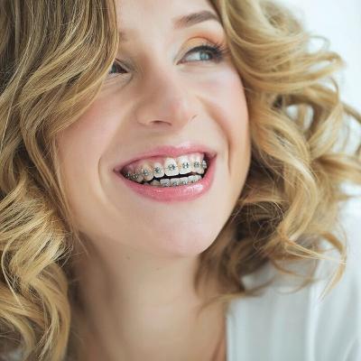 Audio Article: Systematic Review Evaluates Initial Carious Lesion Rates Associated with Fixed Orthodontic Treatment