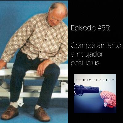 #55: El comportamiento empujador post-ictus #55: El comportamiento empujador post-ictus