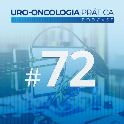 Uro-Oncologia Prática 72 - Controvérsias no manejo do câncer de bexiga localizado linfonodo positivo