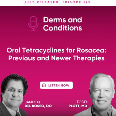 Oral Tetracyclines for Rosacea: Previous and Newer Therapies