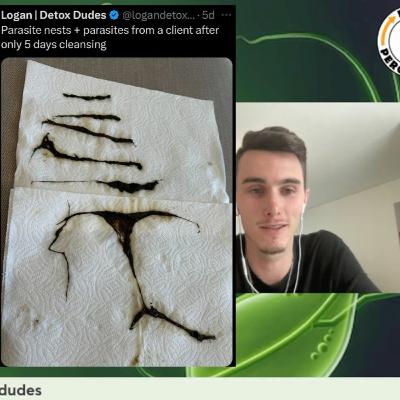 PARASITES 🪱 ARE IN YOUR BODY?  (How To Detox, Fasting, Seed Oils) #podcast