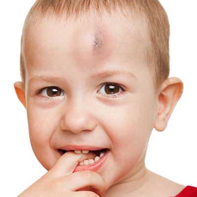 ALL you need to know about HEAD TRAUMA - MCCQE & USMLE Step 2