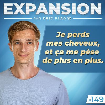 Je perds mes cheveux, et ça me pèse de plus en plus.