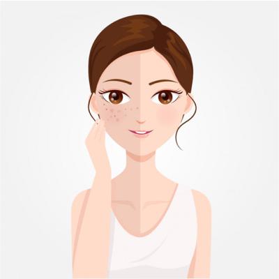 Making do with Melasma