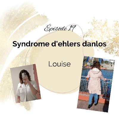 19 - HSD / Syndrome D'Ehlers-Danlos - Louise