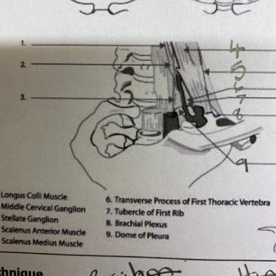 Basic anatomy Stellate Gsnglion - FRCA