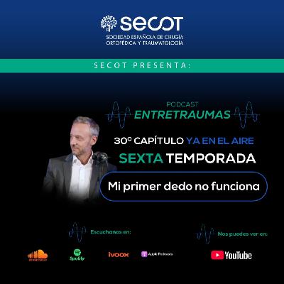 Mi primer dedo no funciona Mi primer dedo no funciona