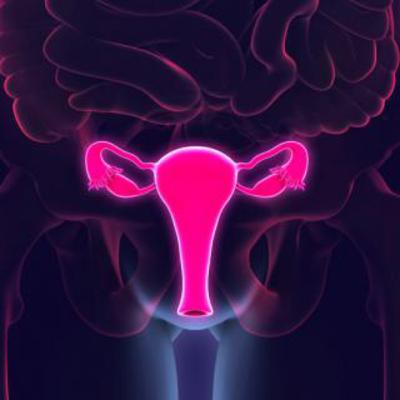 Cancer cervicouterino